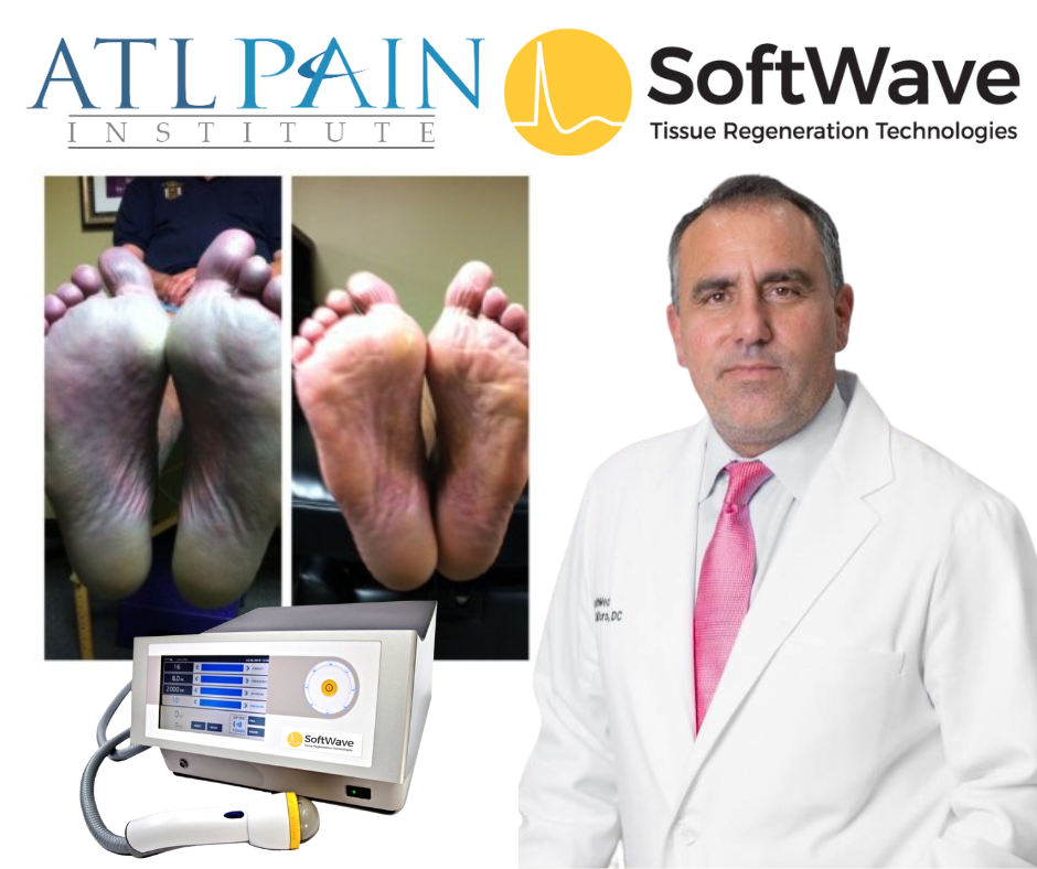 A Breakthrough in Treating Peripheral Neuropathy in Atlanta, GA: SoftWave Tissue Regeneration Therapy at ATL Pain Institute