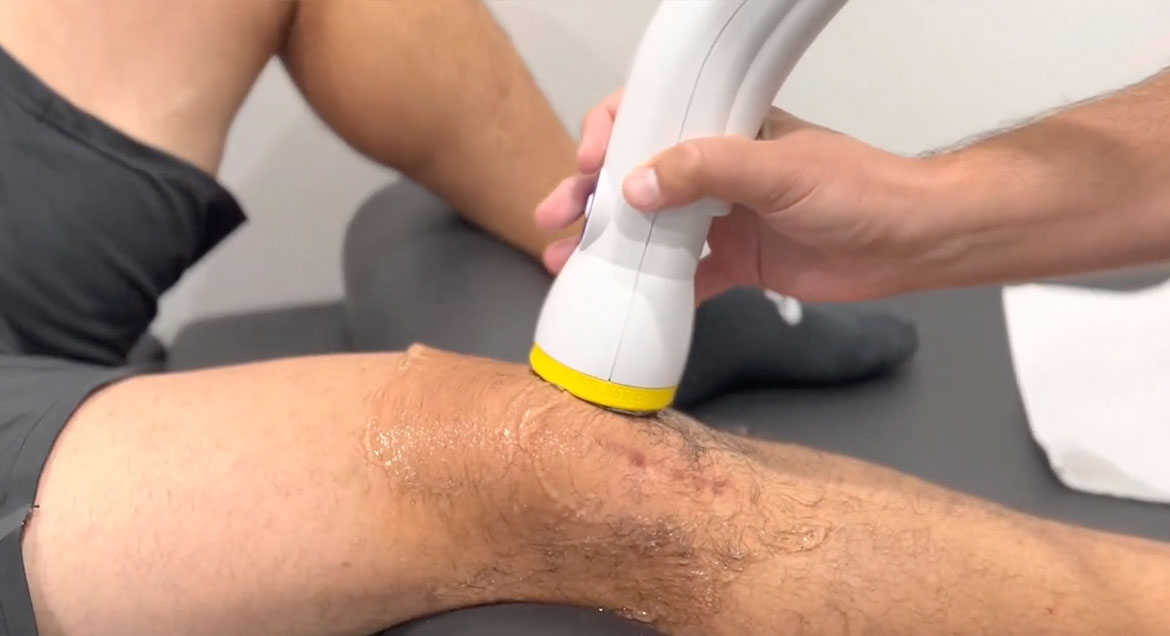 Knee Arthritis Pain Relief in Atlanta, GA with SoftWave Tissue Regeneration Therapy